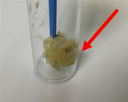不正常大便；2號便大便顏色淺黃；可看到明顯灰